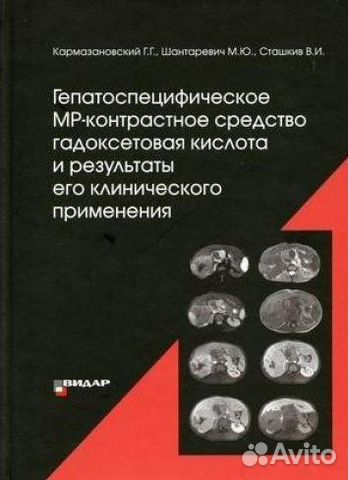 Магнитно-резонансная томография