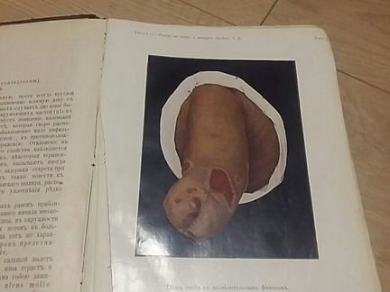 Книга 1913г Кожные и венерические болезни